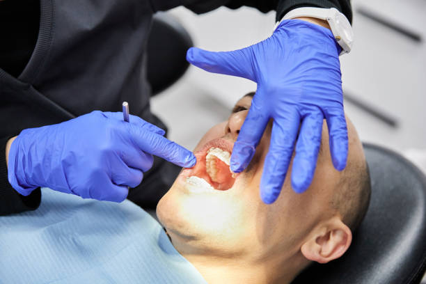 Best Emergency Tooth Extraction in Tton, IL