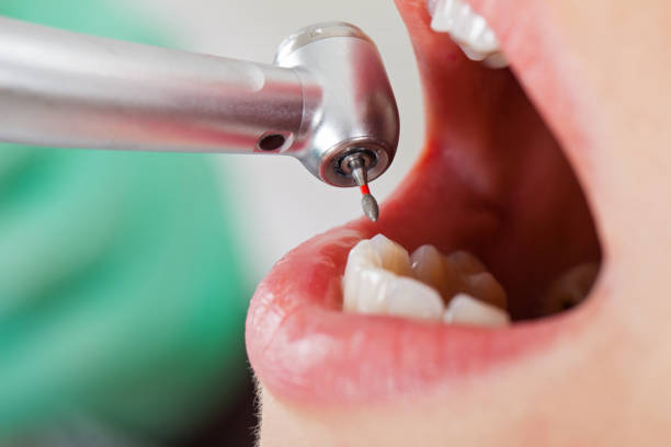 Best Weekend Emergency Dentist in Tton, IL